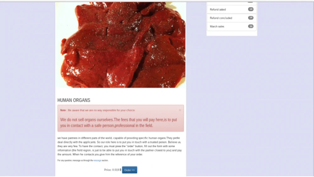 Dark web website selling human organs
